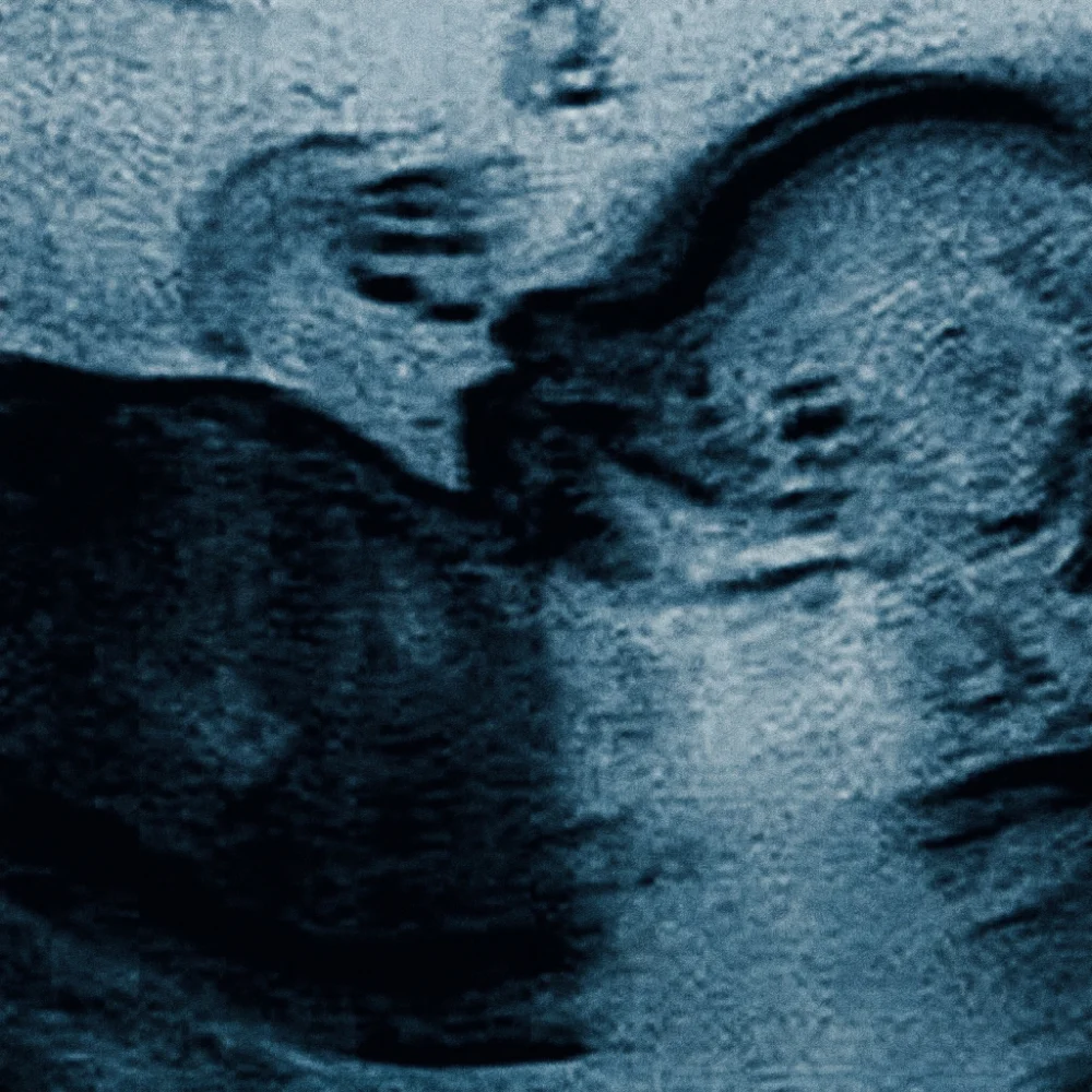 The Passenger EP cover: the first ultrasound photograph of the passenger, by Sophie Kazandjian